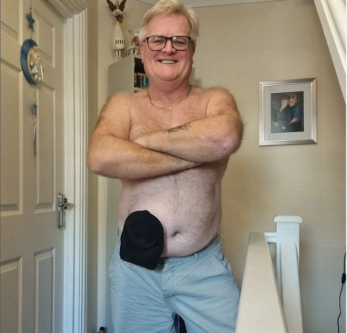 Keith, wearing glasses, stands shirtless with his arms crossed, proudly displaying stoma bag.