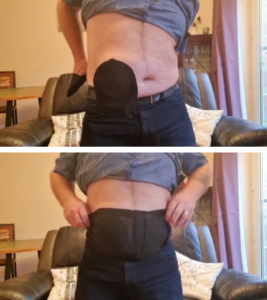  Two photos feature Keith showcasing the application of a stoma wrap/belt around his stomach for support.